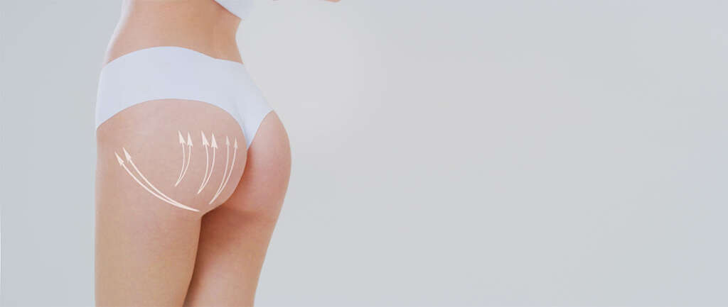 chirurgie fessier