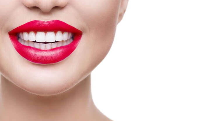 Gummy smile ou sourire gingival : tout savoir