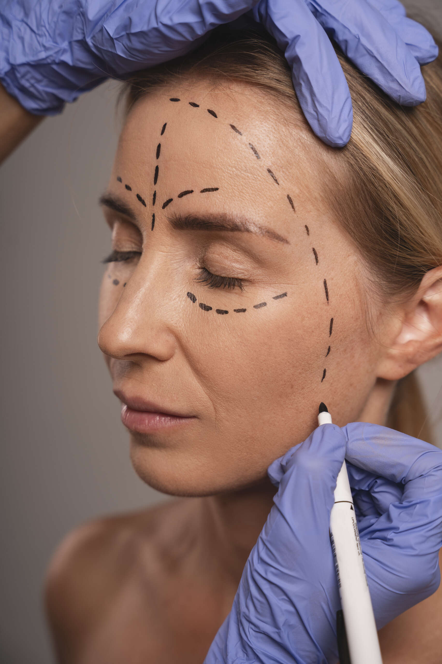 chirurgie esthétique du visage